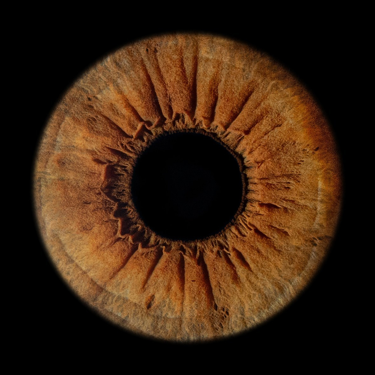 Отзывы. Мой глаз