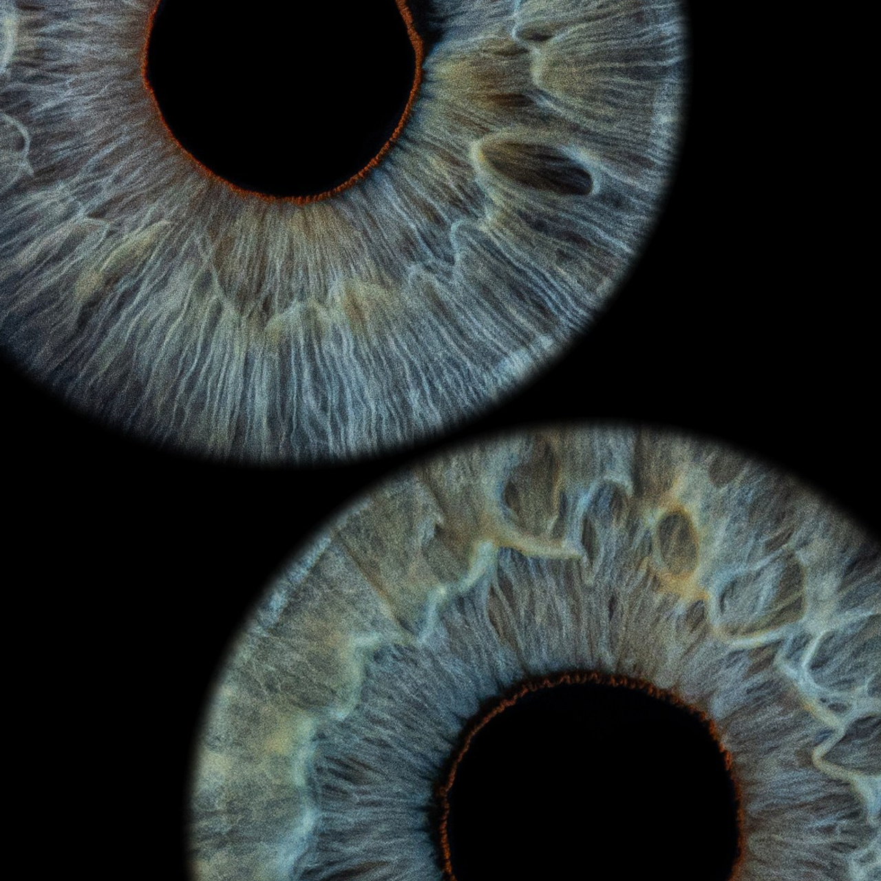 Отзывы. Мой глаз