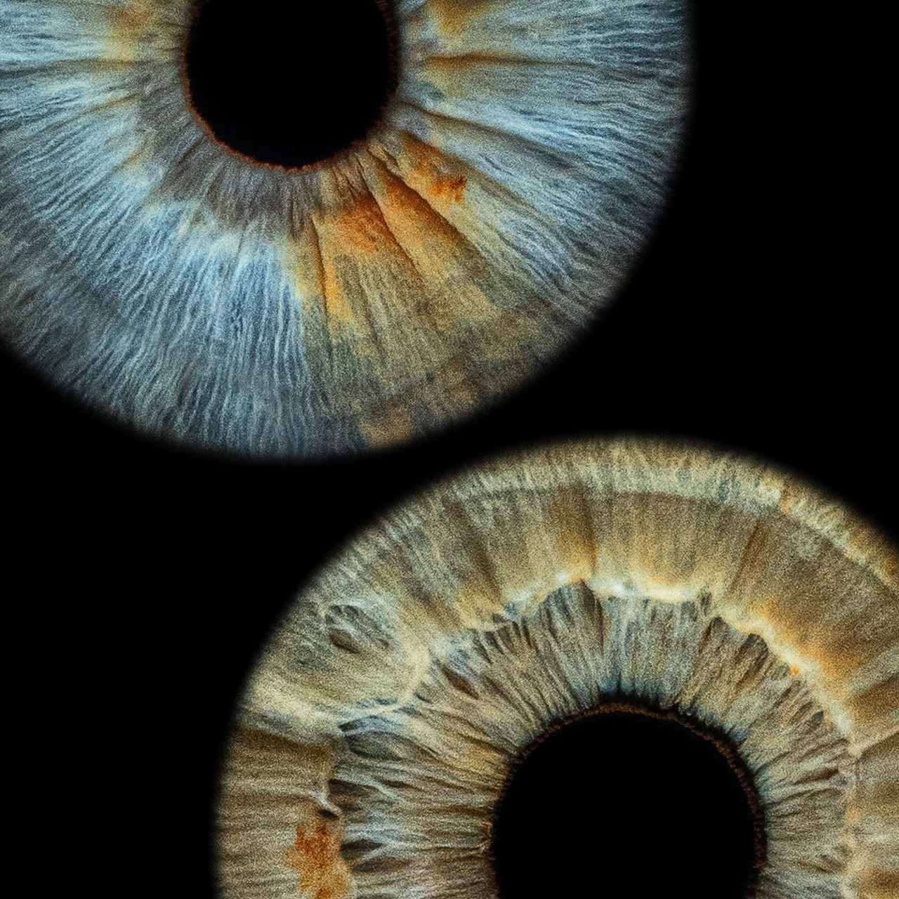 Отзывы. Мой глаз