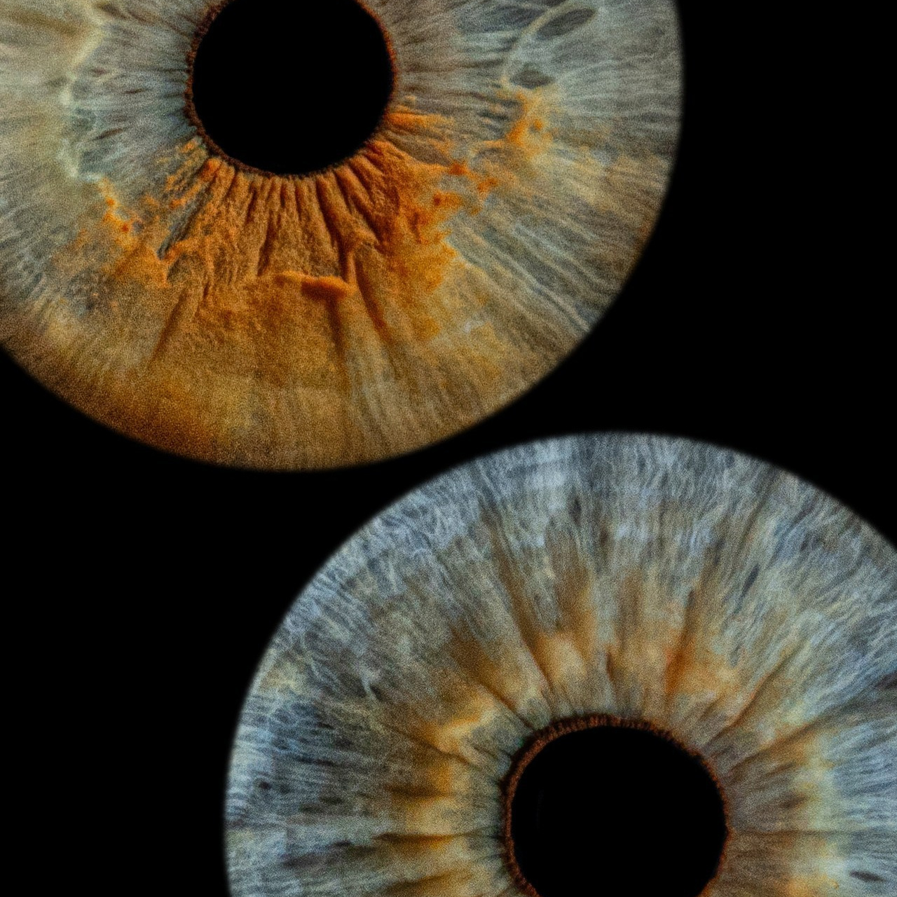 Отзывы. Мой глаз