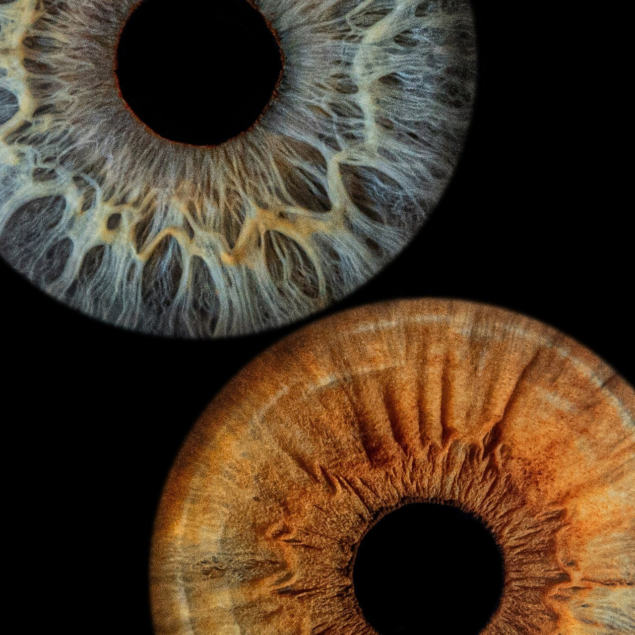 Отзывы. Мой глаз