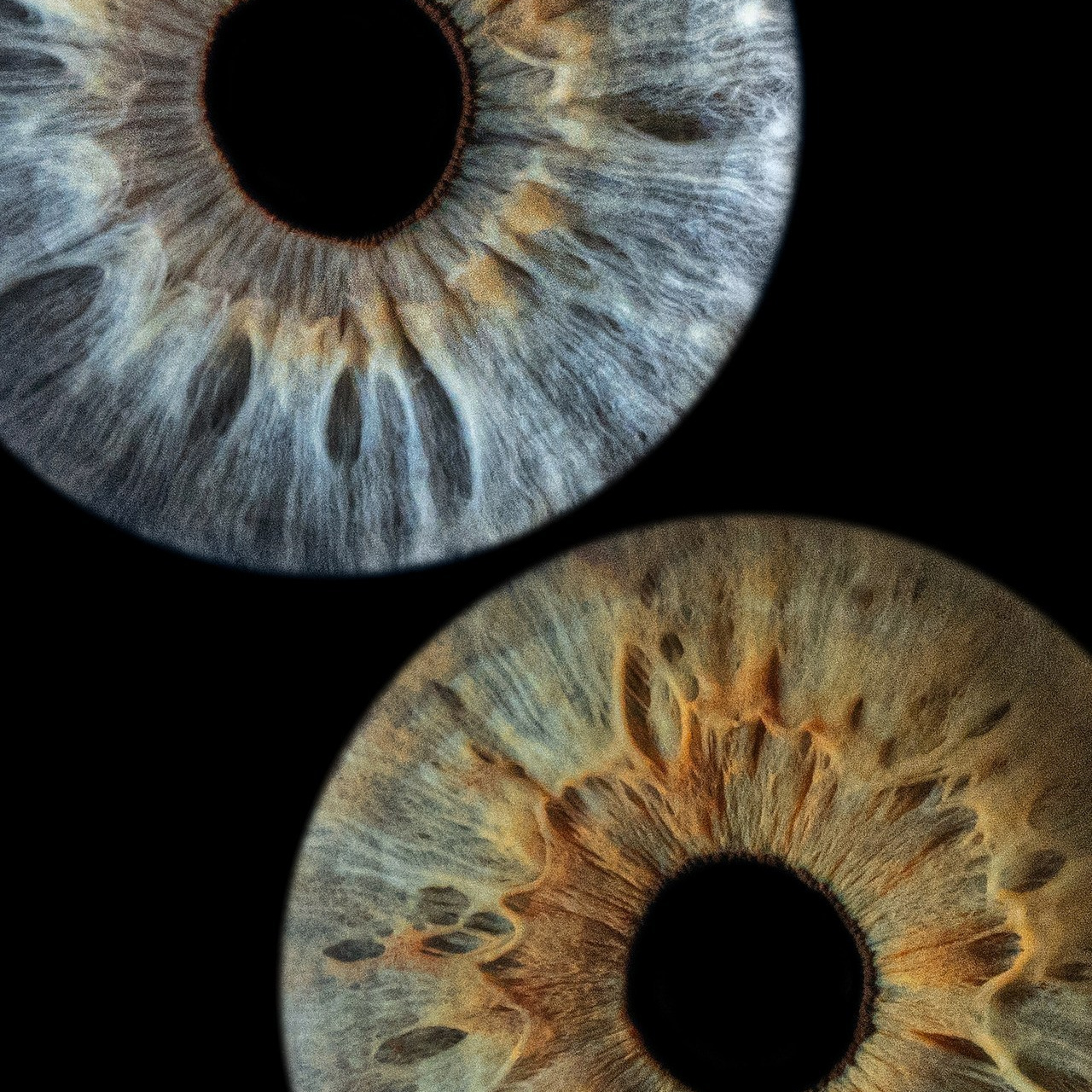 Отзывы. Мой глаз