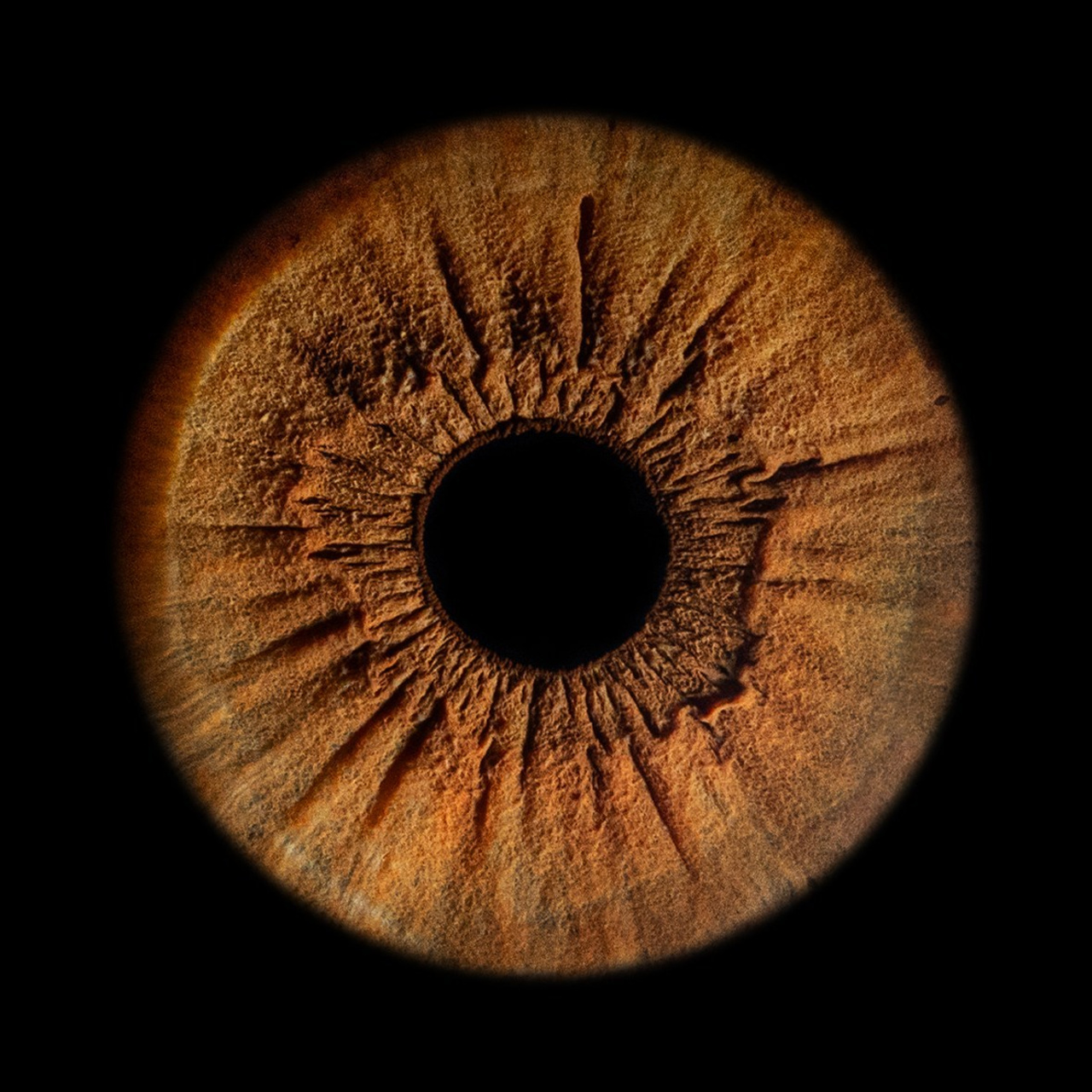 Отзывы. Мой глаз