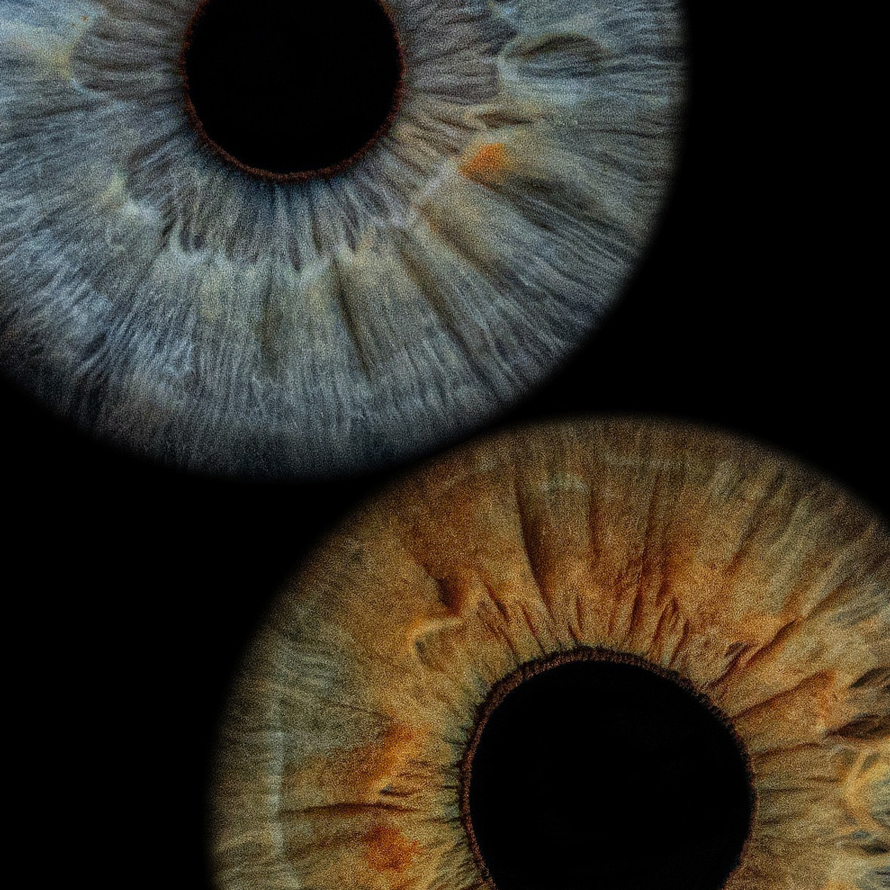 Отзывы. Мой глаз