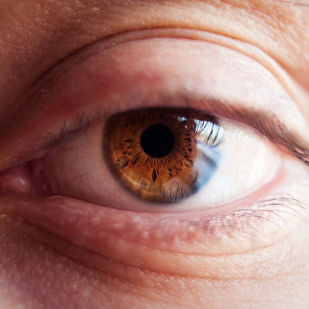 Глазомания