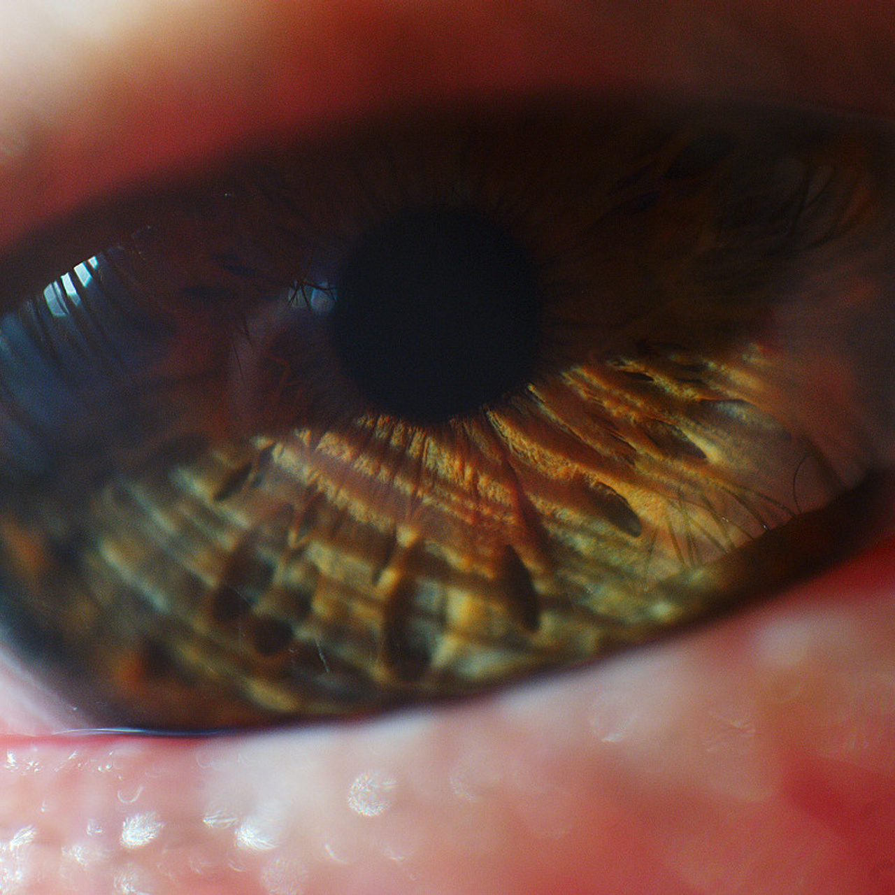 Глазомания