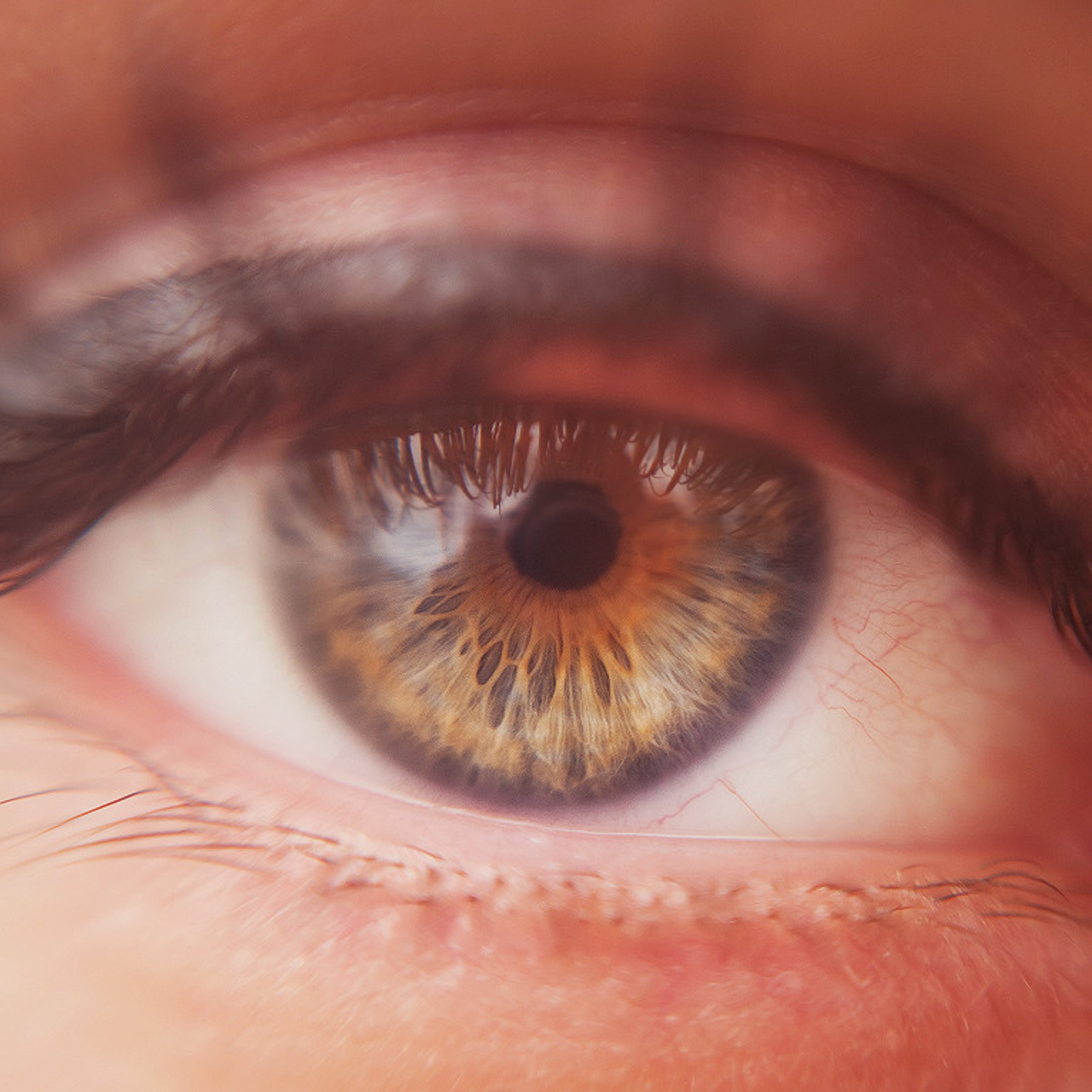 Глазомания