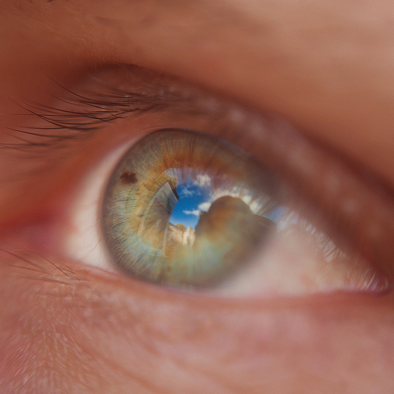 Глазомания