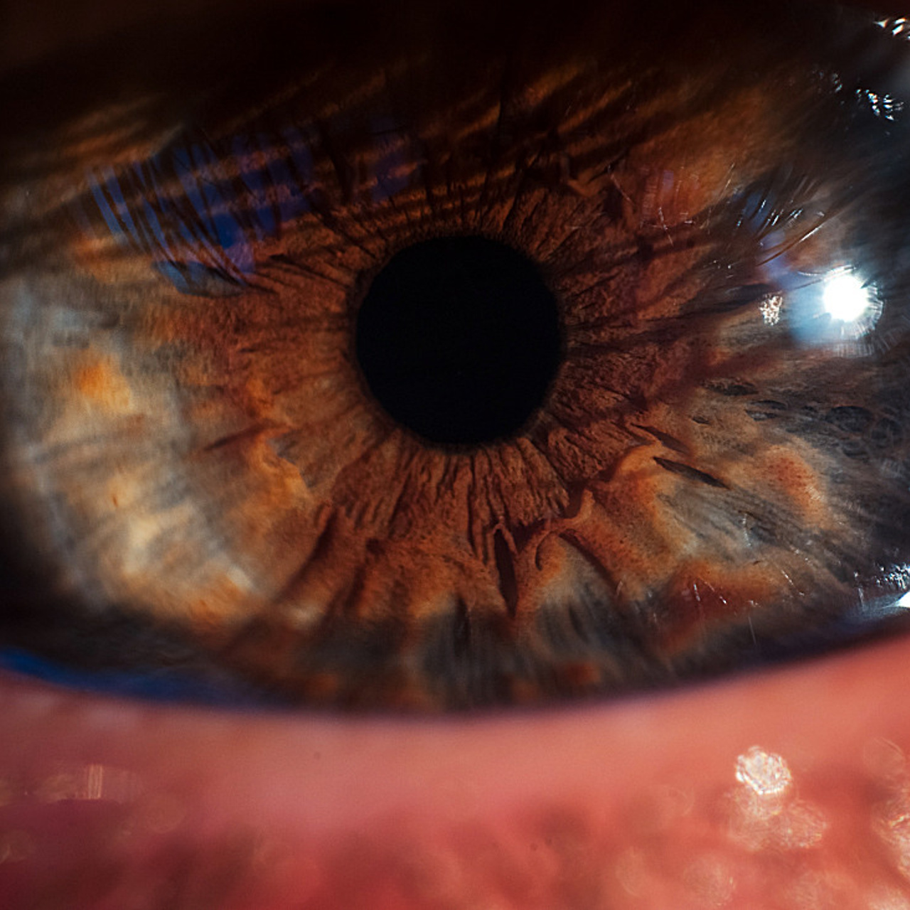 Глазомания