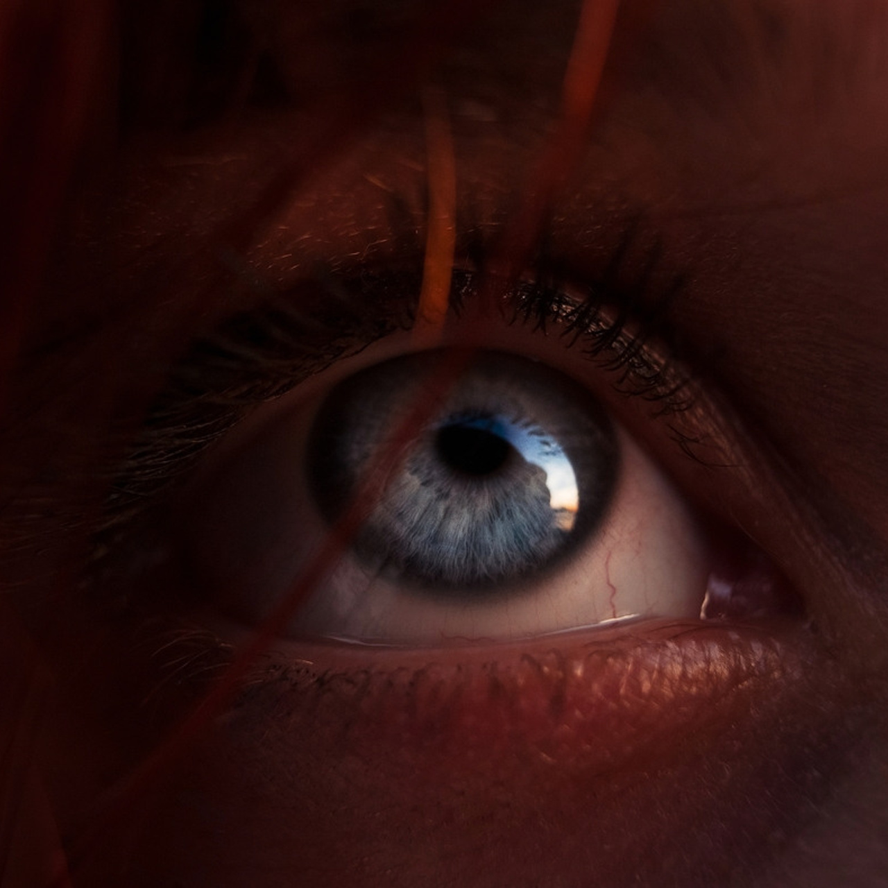 Глазомания