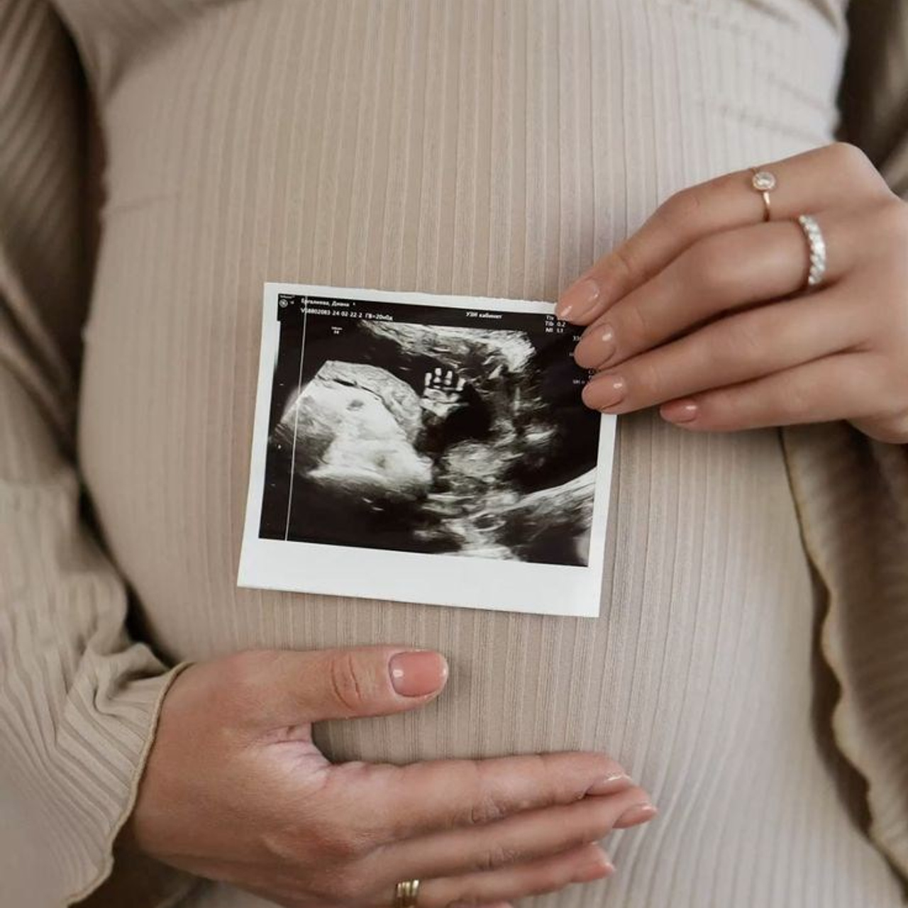 Гендер — пати