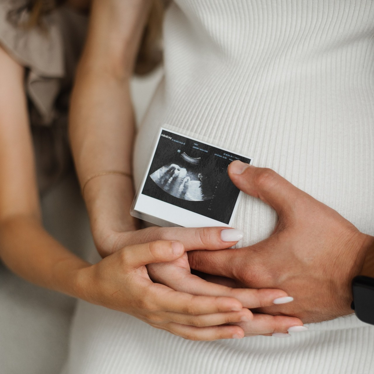 Отзывы. Свадебный фотограф Анастасия Бударина