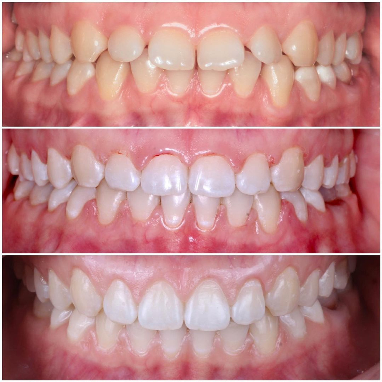 Ортодонтия. Стоматология в Твери - Линия Улыбки