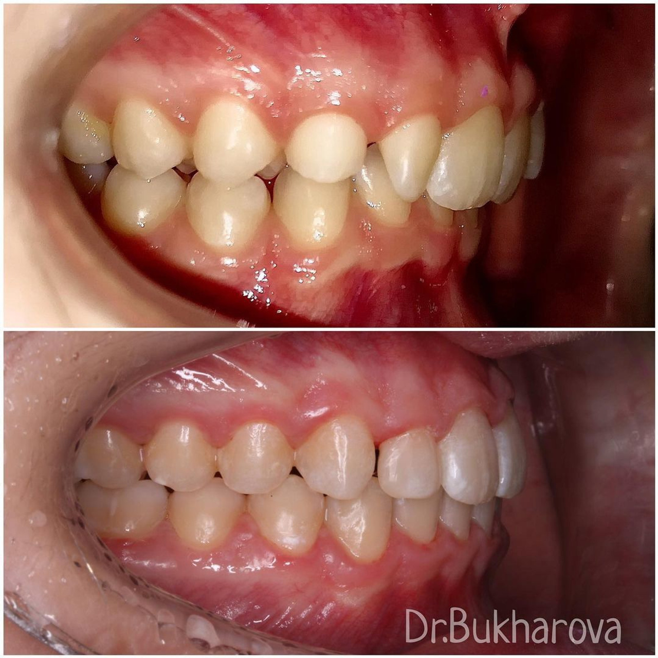 Ортодонтия. Стоматология в Твери - Линия Улыбки