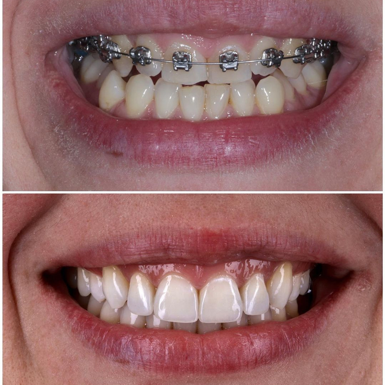 Ортодонтия. Стоматология в Твери - Линия Улыбки