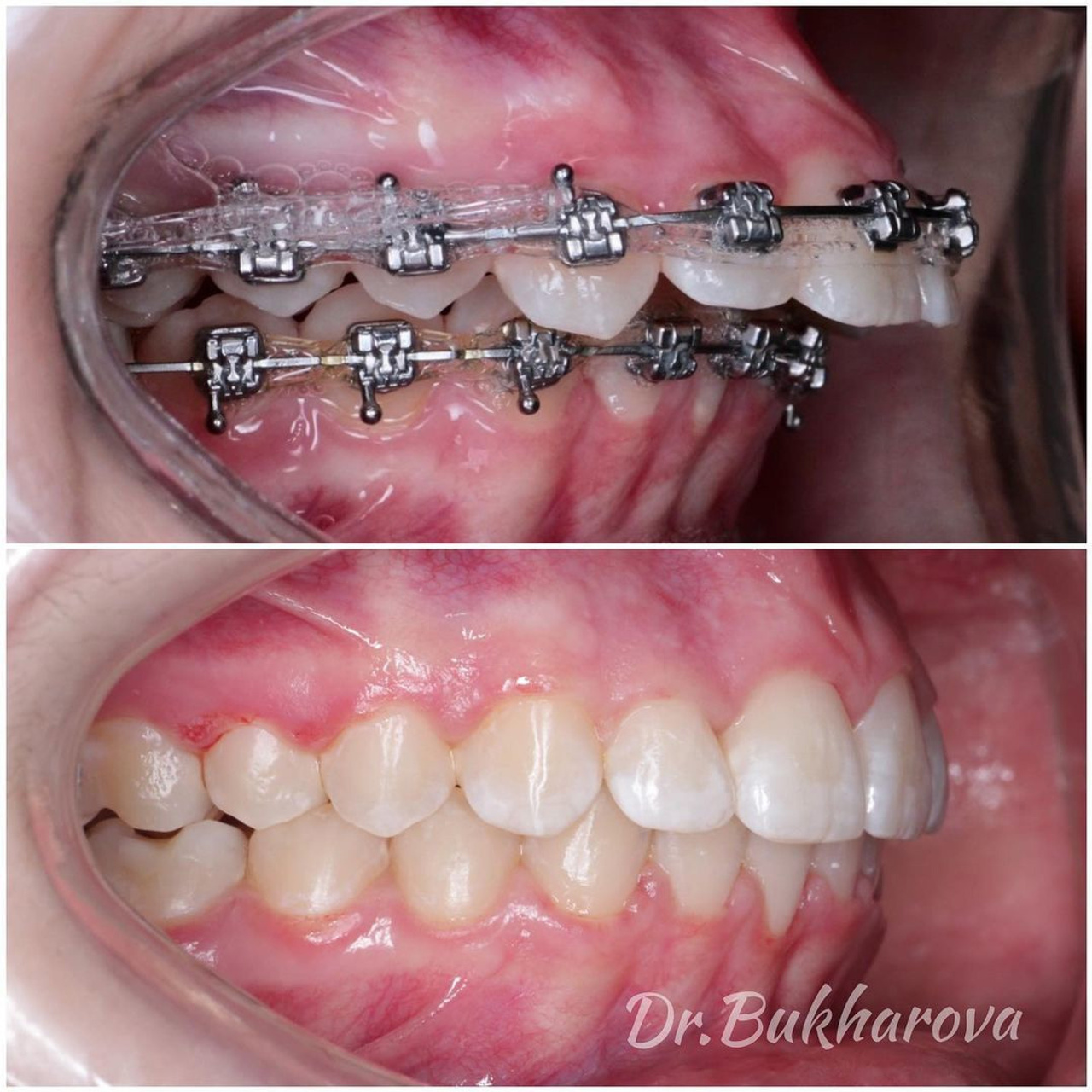 Ортодонтия. Стоматология в Твери - Линия Улыбки