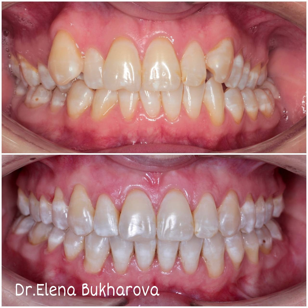 Ортодонтия. Стоматология в Твери - Линия Улыбки