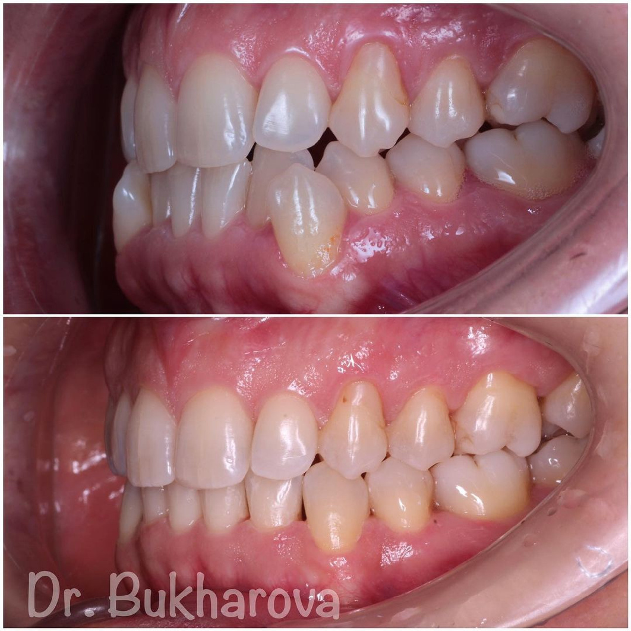 Ортодонтия. Стоматология в Твери - Линия Улыбки