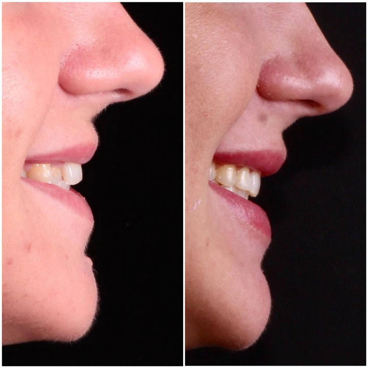 Ортодонтия. Стоматология в Твери - Линия Улыбки