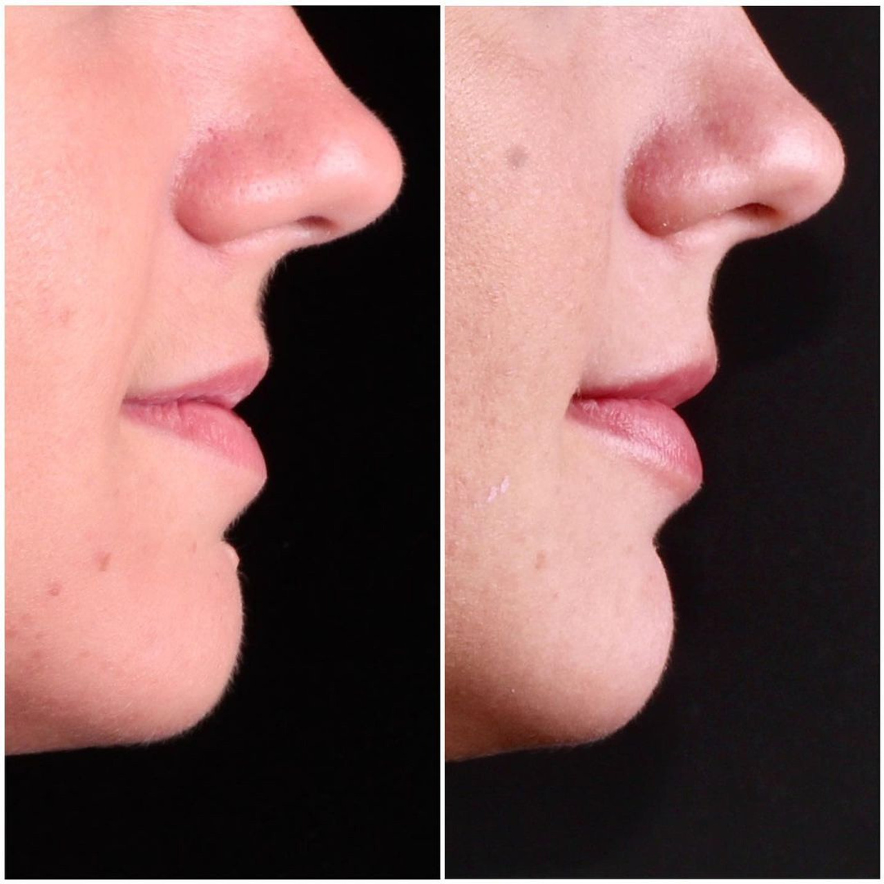 Ортодонтия. Стоматология в Твери - Линия Улыбки