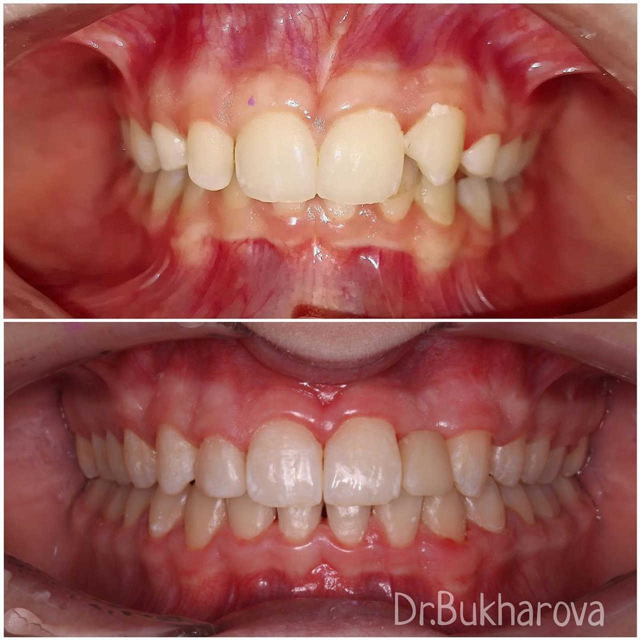 Ортодонтия. Стоматология в Твери - Линия Улыбки