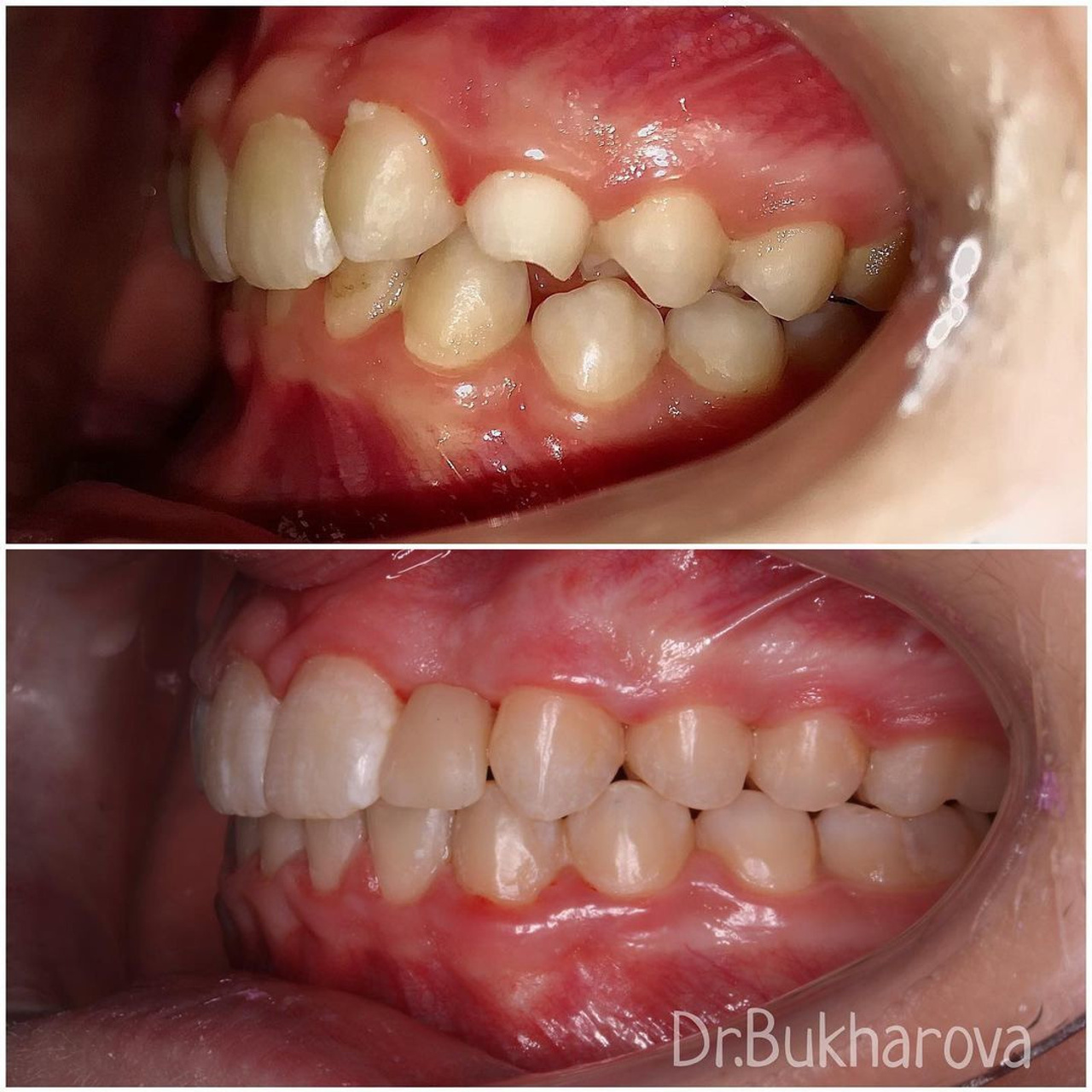 Ортодонтия. Стоматология в Твери - Линия Улыбки
