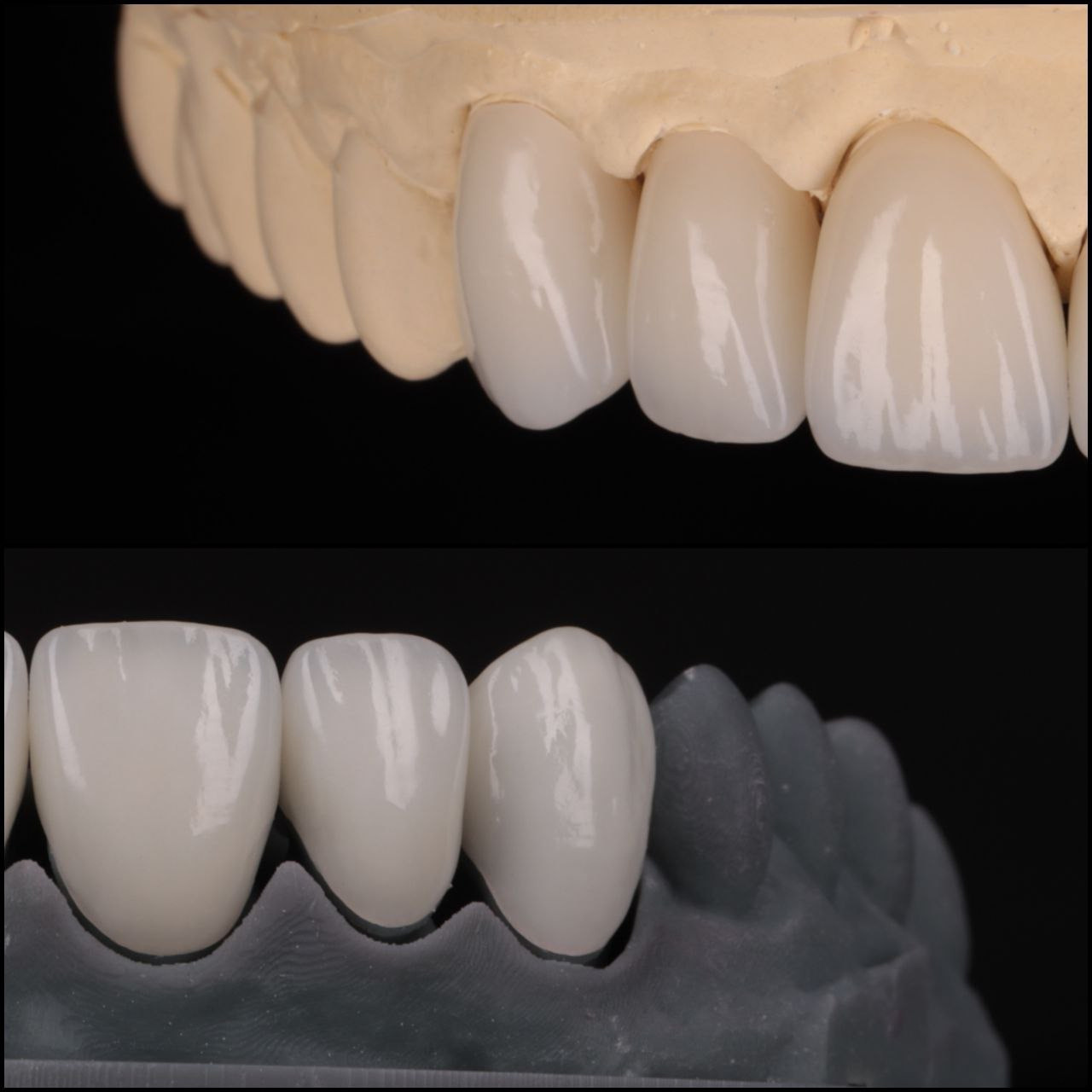Стоматология в Твери - Линия Улыбки Коронки. Стоматология в Твери - Линия Улыбки