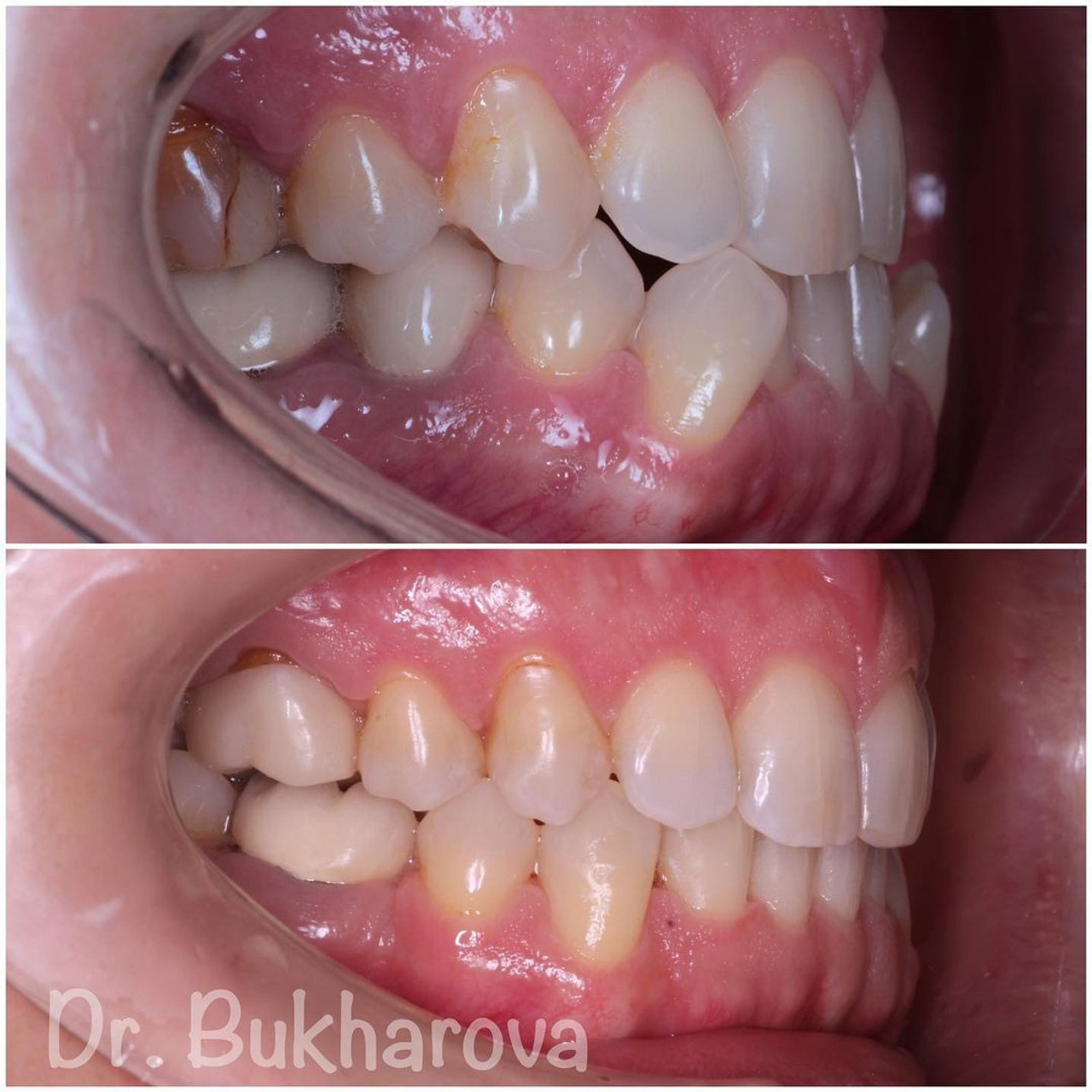 Ортодонтия. Стоматология в Твери - Линия Улыбки