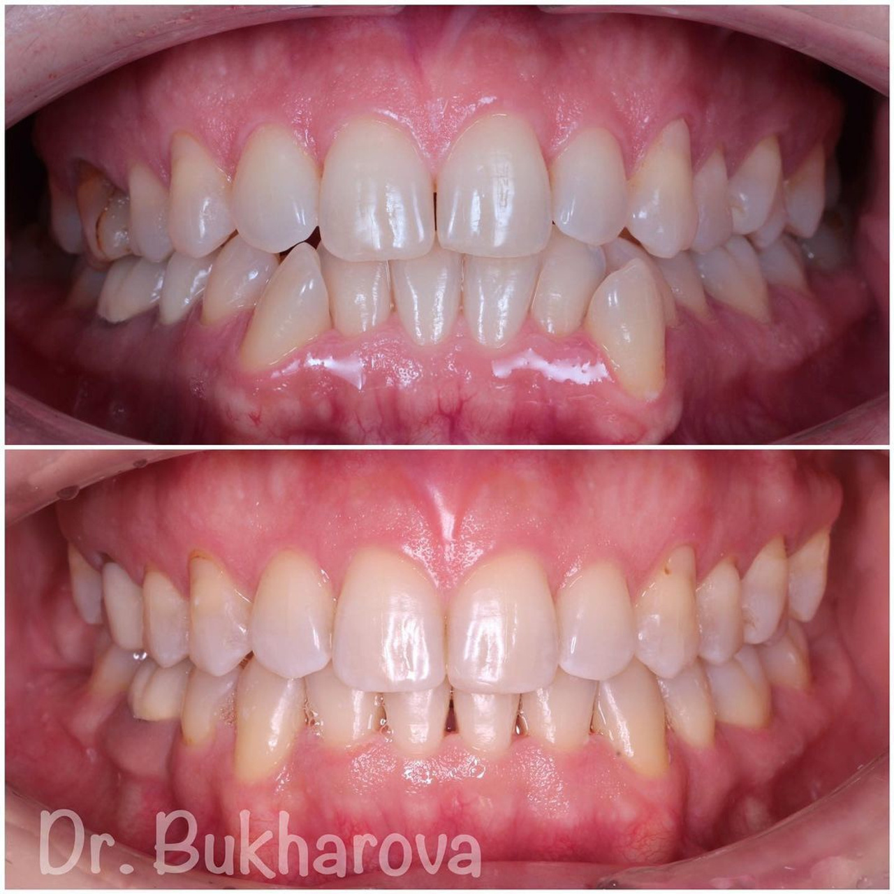 Ортодонтия. Стоматология в Твери - Линия Улыбки