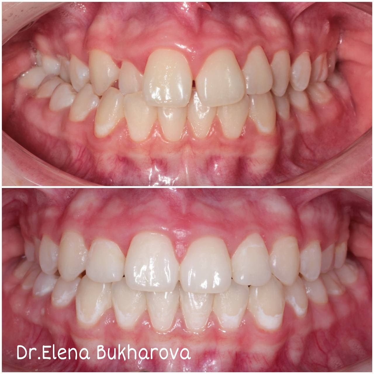 Ортодонтия. Стоматология в Твери - Линия Улыбки