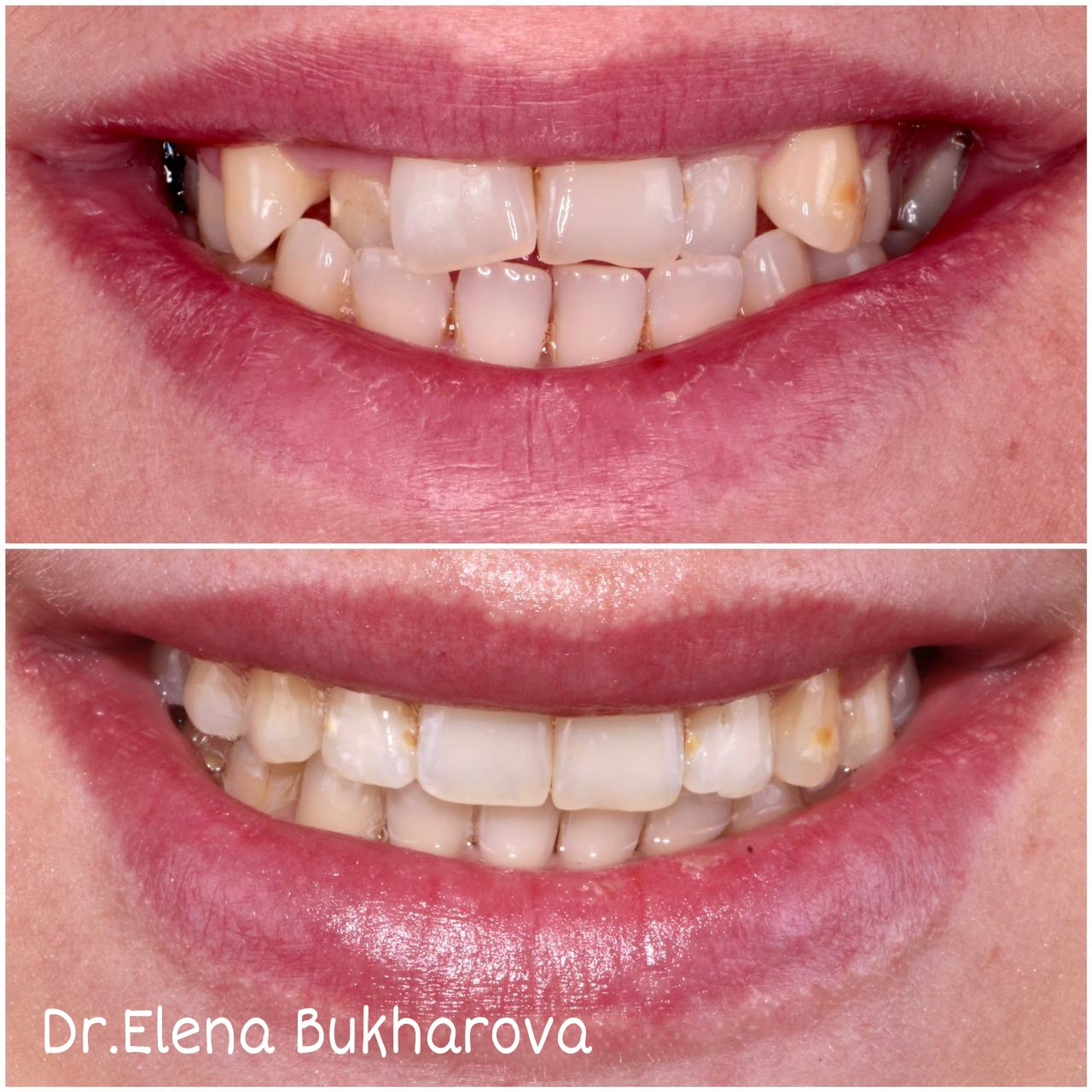 Ортодонтия. Стоматология в Твери - Линия Улыбки