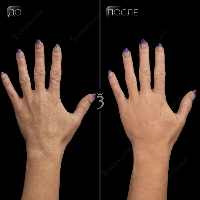 Кейсы. Sergey Shapovalov, фотограф, видеограф, графический дизайнер, монтажер