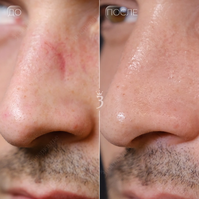 Кейсы. Sergey Shapovalov, фотограф, видеограф, графический дизайнер, монтажер