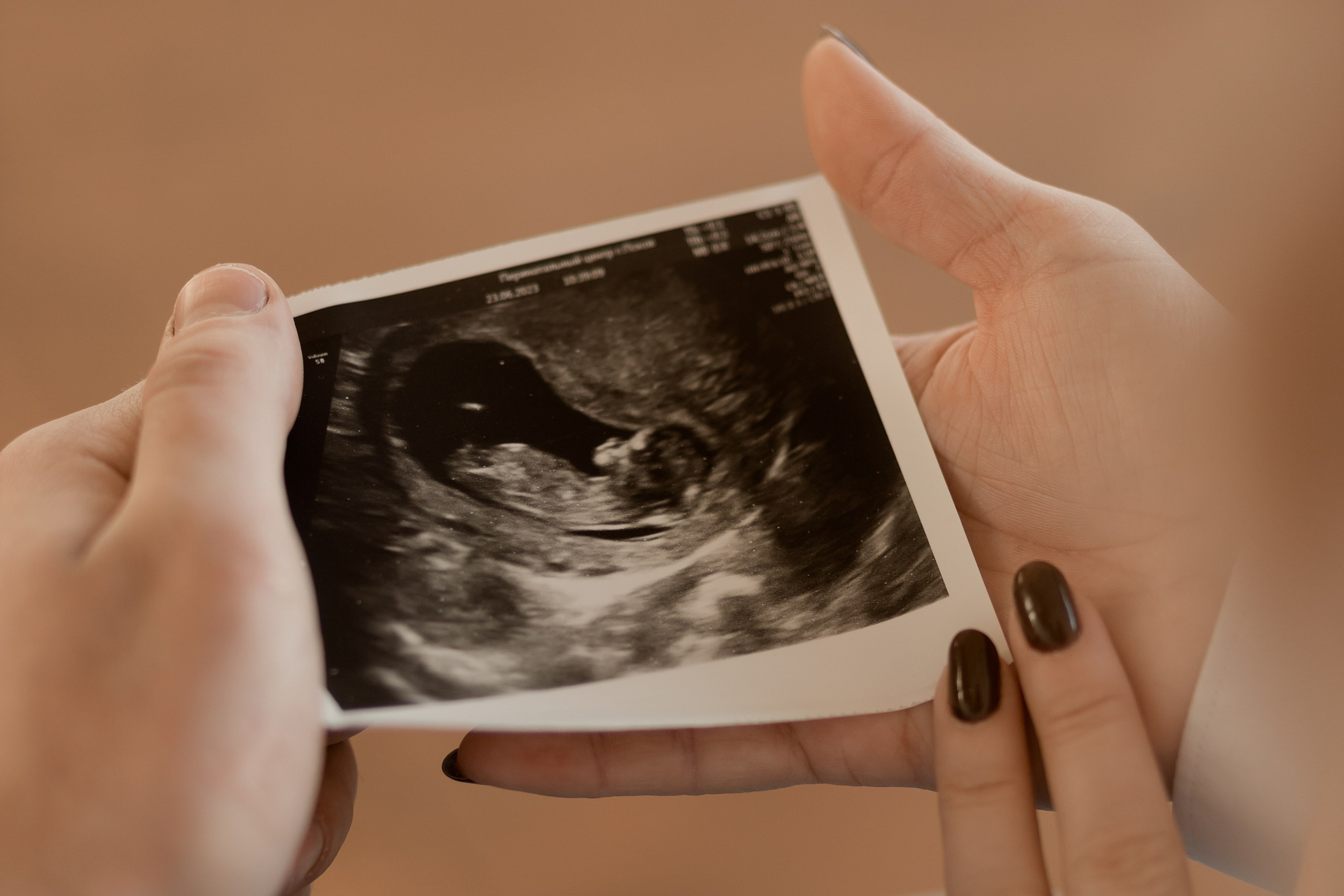 В ожидании. Свадебный фотограф в Пскове и Санкт-Петербурге | Анна Голикова