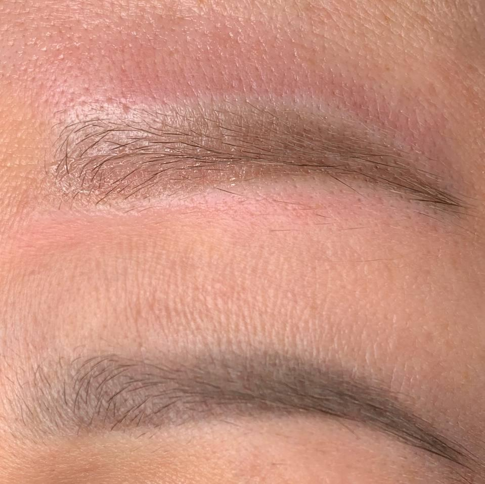 Удаление ПМ. Студия перманентного макияжа, косметологии и массажа SYMMETRY в Москве, м. Киевская