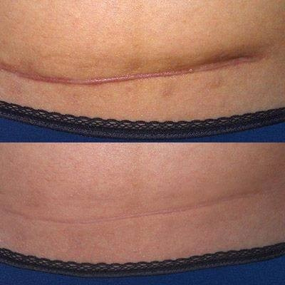 Элла. Студия перманентного макияжа, косметологии и массажа SYMMETRY в Москве, м. Киевская