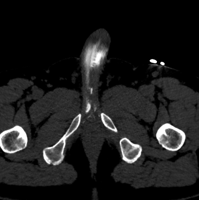 ЭРЕКТИЛЬНАЯ ДИСФУНКЦИЯ. РЕНТГЕН КТ МРТ в Санкт-Петербурге Александра Лоншакова