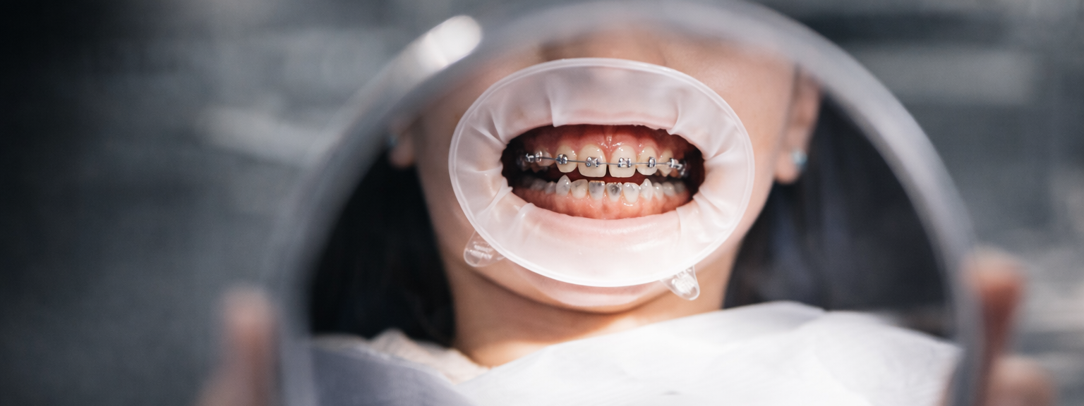 Услуги. Стоматолог ортодонт-гнатолог в Москве