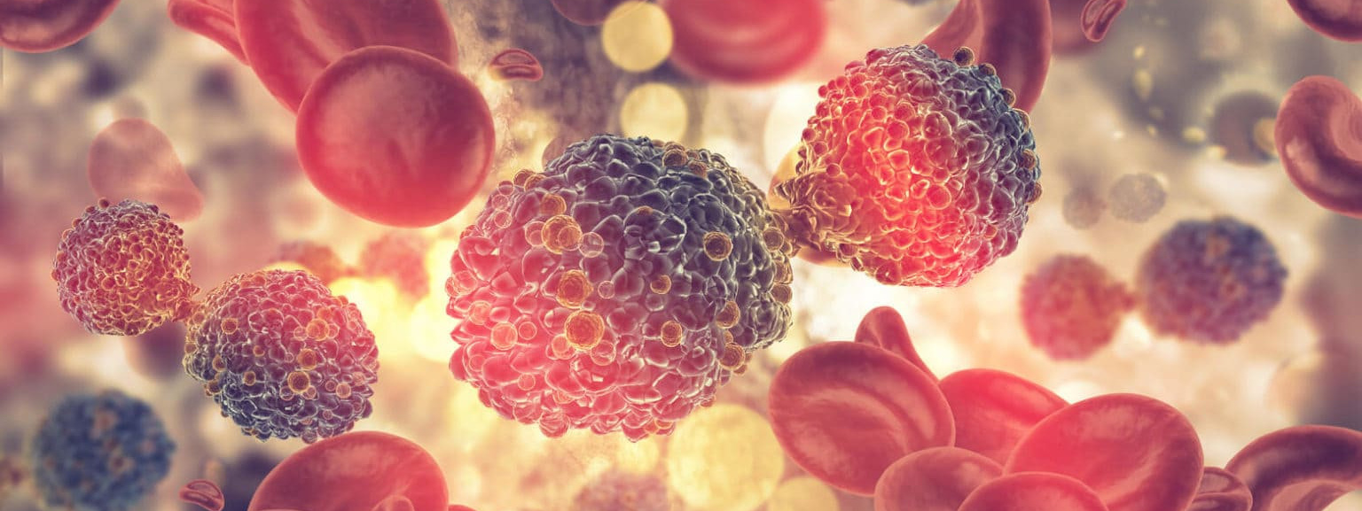 Заболевания крови: анемия, лейкемия. «Сово-Сова» продукция для омоложения, здоровья и долголетия