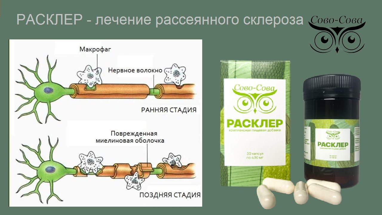 Рассеянный склероз. Диагностика на ранних стадиях. Сово-Сово — Омоложение и оздоровление!