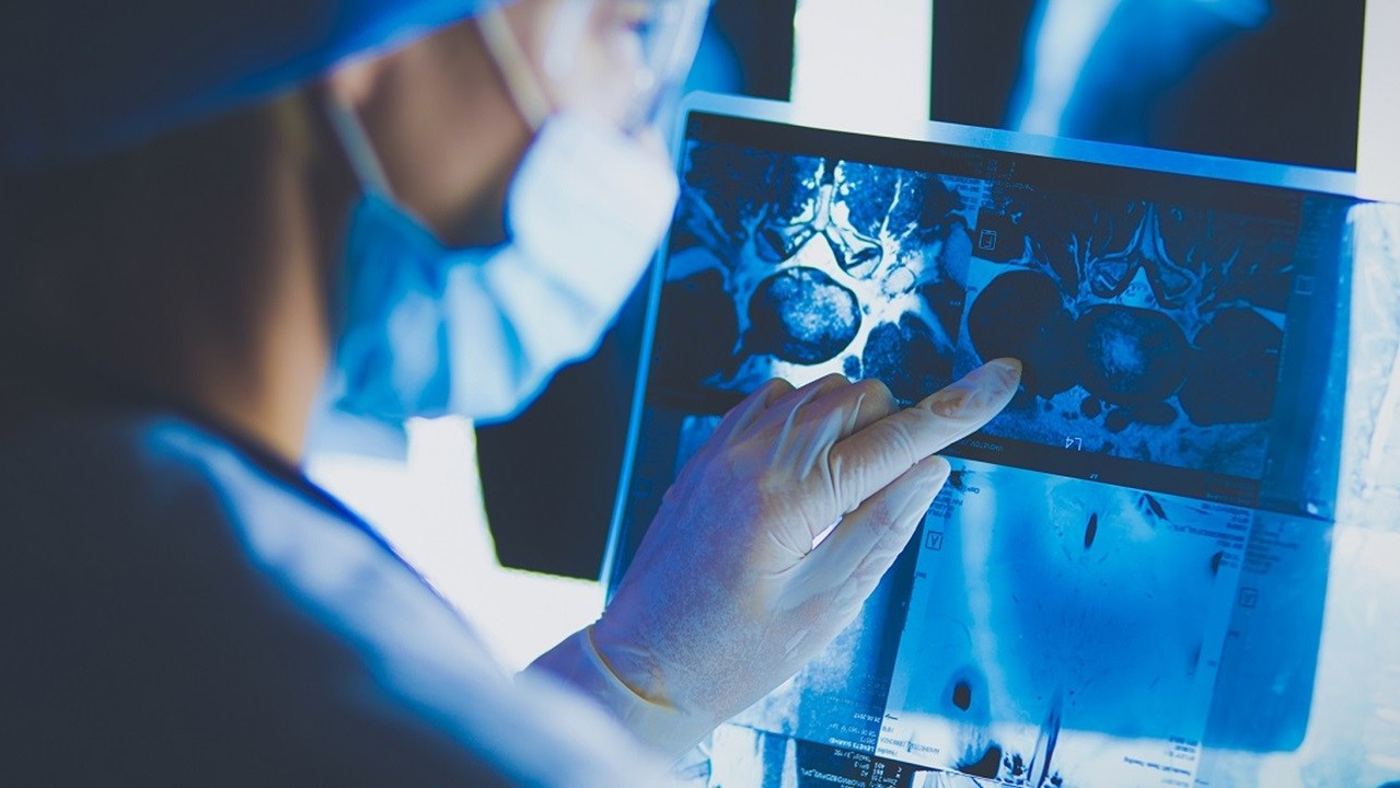 При любой онкопатологии -  какие препараты компании Сово-Сова принимать. Какие КПД помогут при онкологии