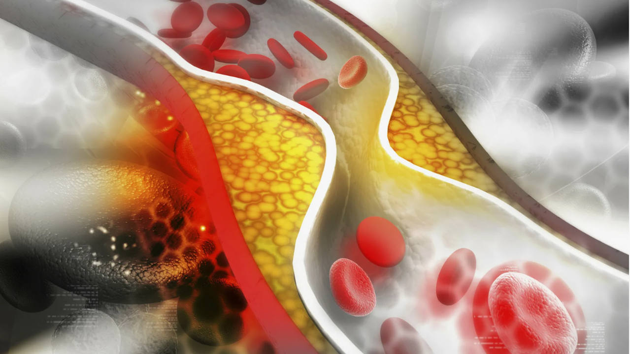Растворение холестериновых бляшек, тромбов. снижение холестерина в&nbsp;крови, чистка сосудов - какие продукты компании  Сово-Сова принимать