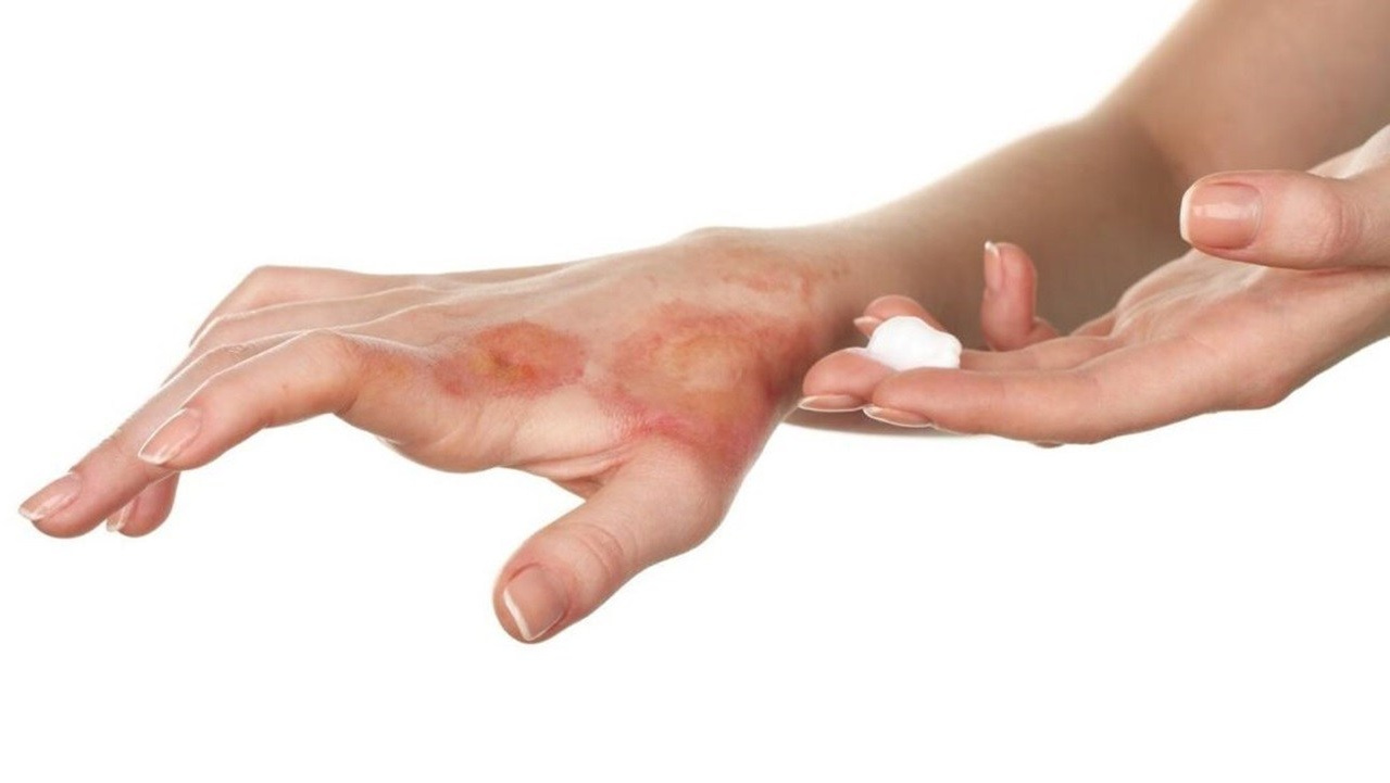 Системная красная волчанка, системная склеродермия, синдром Шегрена, смешанное заболевание соединительной ткани, полиомиозит или дерматомиозит, ревматоидный артрит, миастения Гравис, рассеянный склероз - какие препараты компании Сово-Сова помогут решить проблему