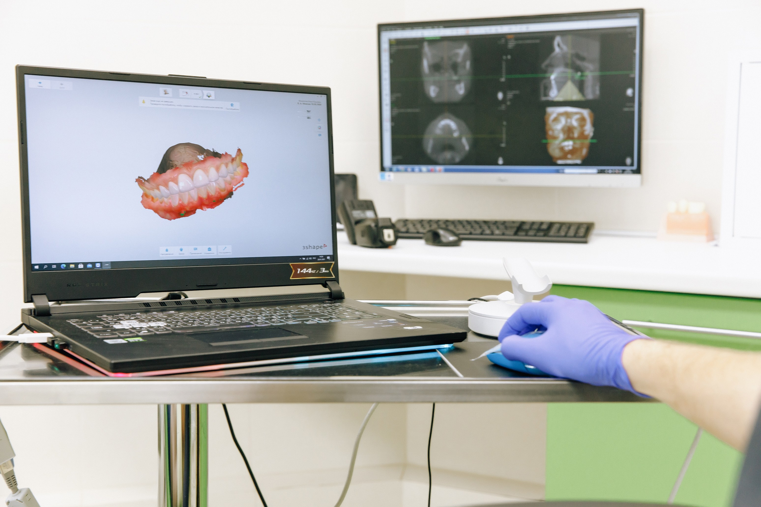 имплантация зубов,удаление зубов,хирургия,зуб мудрости,тверь,стоматолог,имплантолог,синус-лифтинг,костная пластика