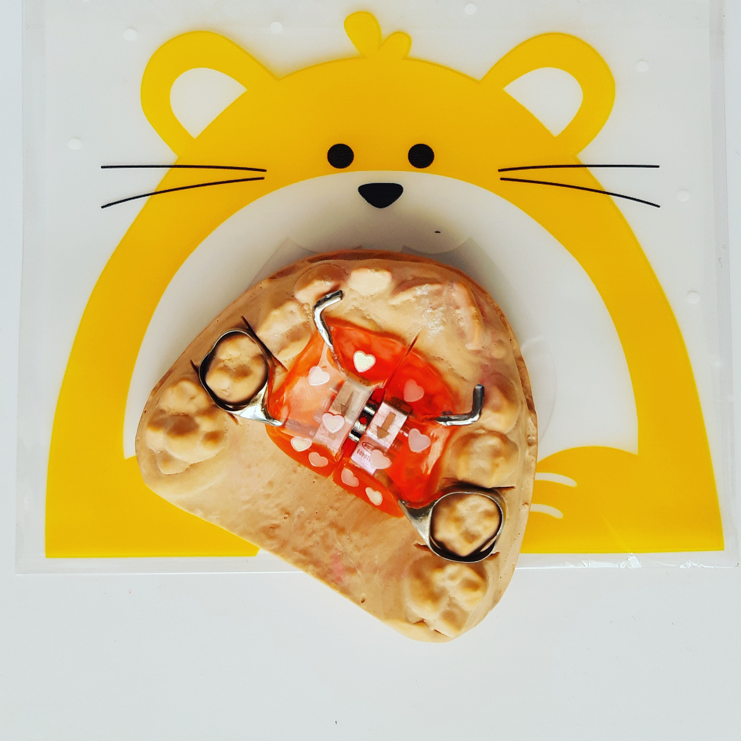 Блог врача. Стоматология «Ортодонт-Эстетик». Установка брекетов в Оренбурге, взрос