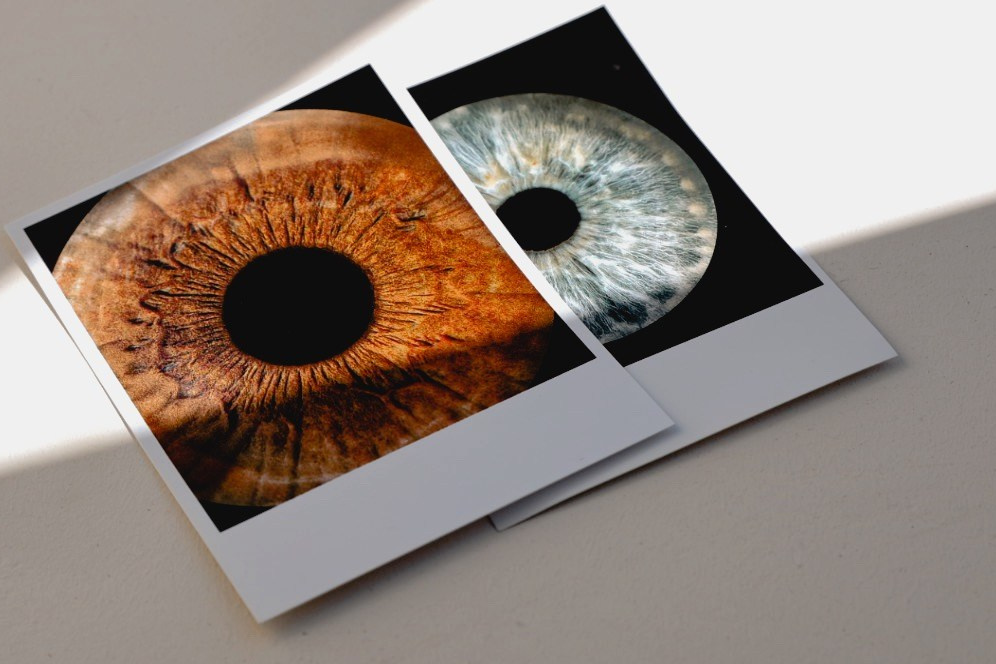 Услуги. Макро Фото радужки глаза в Зеленоградске