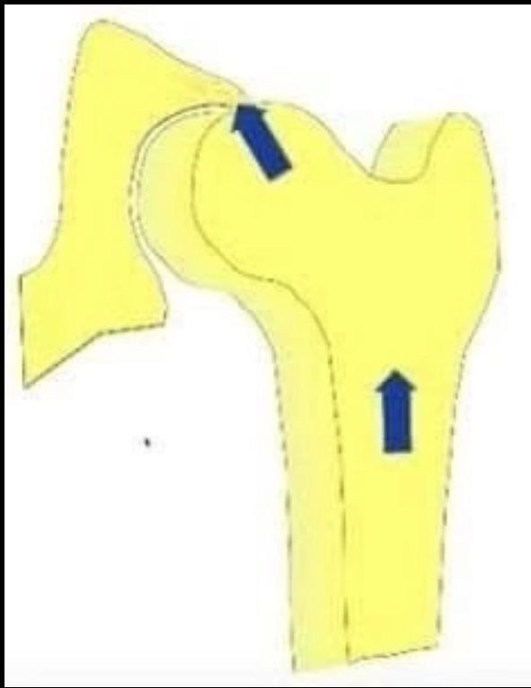 ✅10 фактов о дисплазии тазобедренного сустава у собак. ПИТОМНИК СОБАК ПОРОДЫ АМЕРИКАНСКИЙ БУЛЛИ