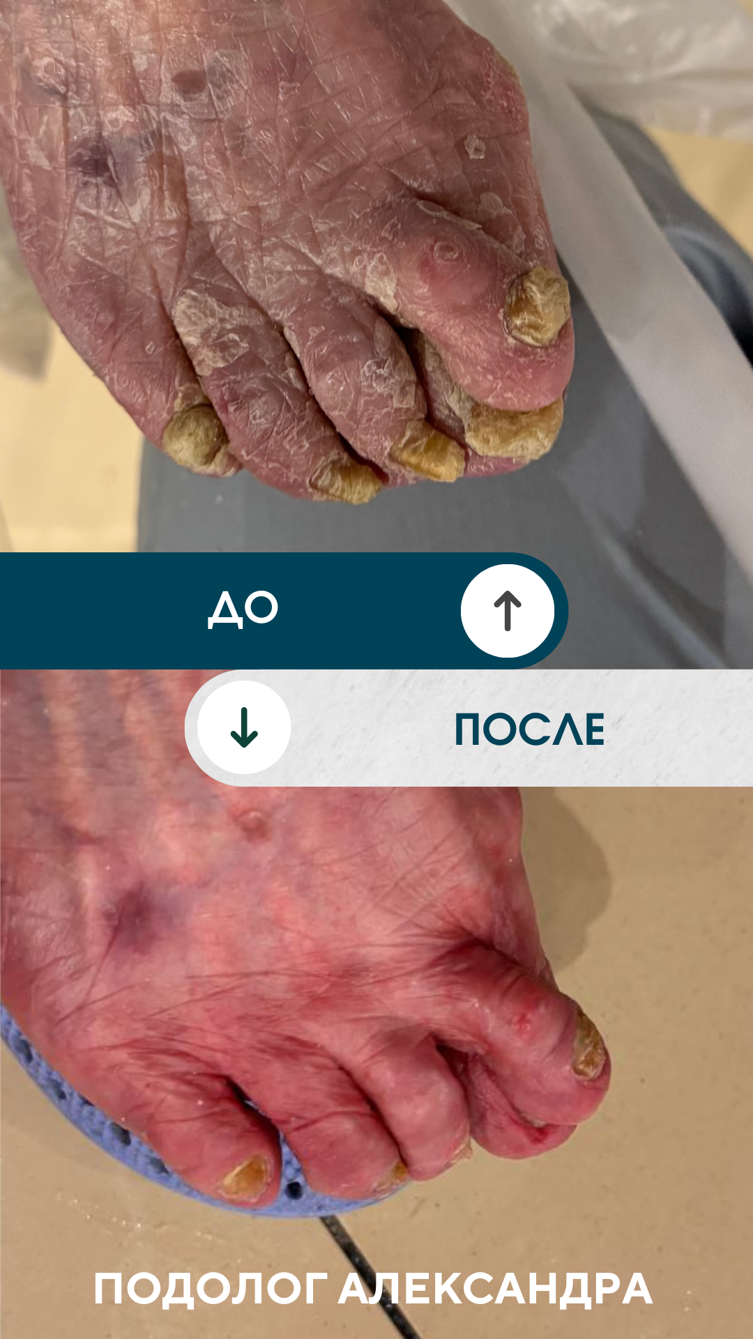 Благотворительный выезд в пансионат. Подолог г. Хабаровск — центр здоровой стопы «FOOTTIME»