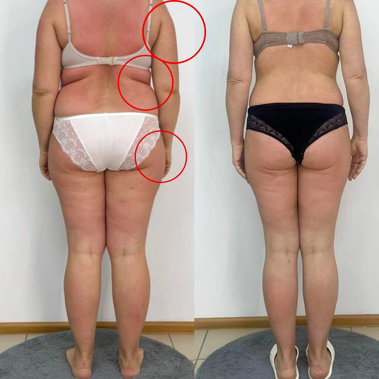 Результаты. Центр Коррекции Тела в городе Чехов