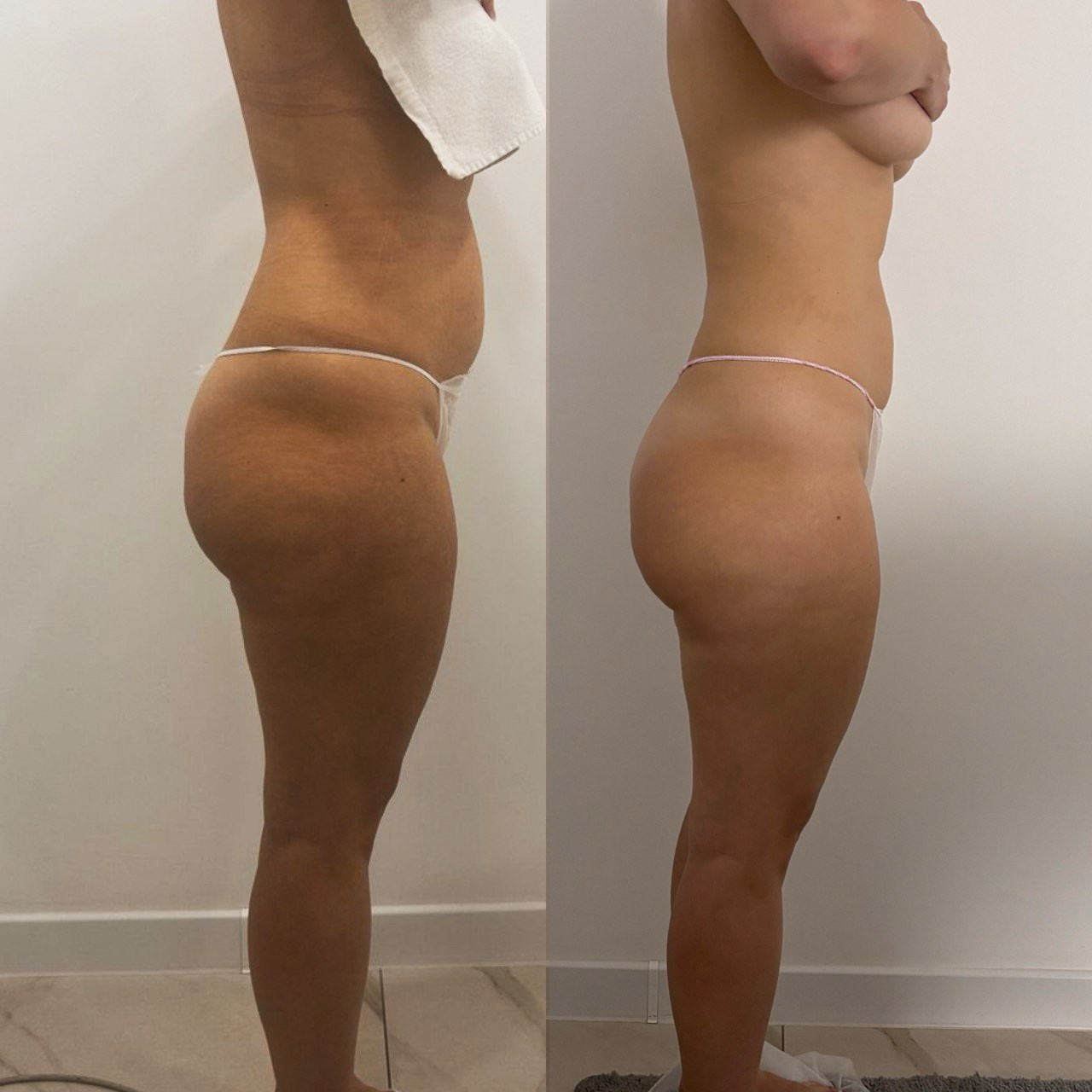 Аппаратный массаж, эндосфера, ручной массаж. Студия перманентного макияжа, косметологии и массажа SYMMETRY в Москве, м. Киевская